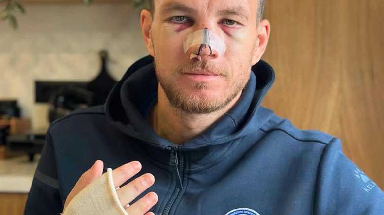 Edin Dzeko's Harrowing Injury: A Star's Struggle on the International Stage